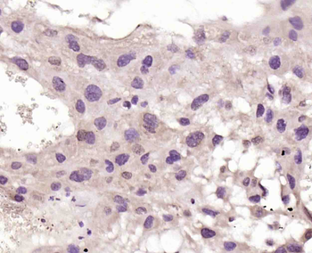 GPR30 Rabbit Polyclonal Antibody