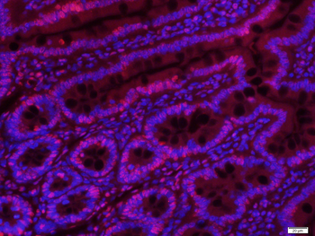 Histone H3 Mouse Monoclonal Antibody (Nuclear Loading Control)