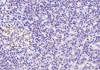Histone H3 Mouse Monoclonal Antibody (Nuclear Loading Control)