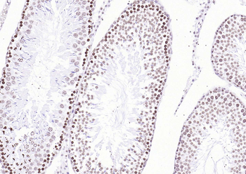 Histone H3 Mouse Monoclonal Antibody (Nuclear Loading Control)