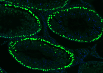 Histone H3 Mouse Monoclonal Antibody (Nuclear Loading Control)