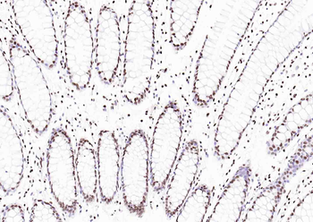 Histone H3 Mouse Monoclonal Antibody (Nuclear Loading Control)