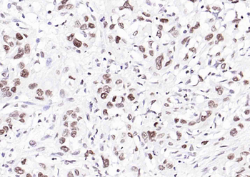 Histone H3 Mouse Monoclonal Antibody (Nuclear Loading Control)