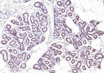 Histone H3 Mouse Monoclonal Antibody (Nuclear Loading Control)