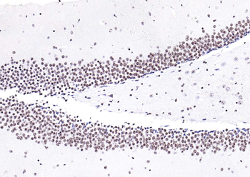 Histone H3 Mouse Monoclonal Antibody (Nuclear Loading Control)