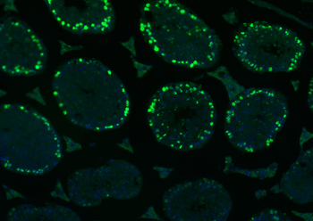 Histone H3 Mouse Monoclonal Antibody (Nuclear Loading Control)