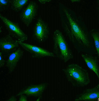 GAPDH Rabbit Polyclonal Antibody (Loading Control)