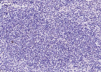 GAPDH Rabbit Polyclonal Antibody (Loading Control)