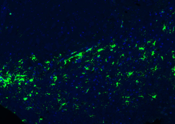 GFAP Rabbit Polyclonal Antibody