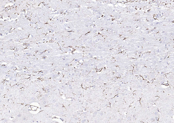 GFAP Rabbit Polyclonal Antibody