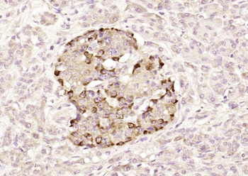 Bcl-2 Rabbit Polyclonal Antibody