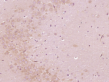 Bcl-2 Rabbit Polyclonal Antibody
