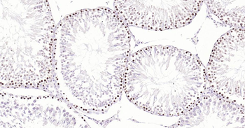 PCNA Mouse Monoclonal Antibody (Nuclear Loading Control)