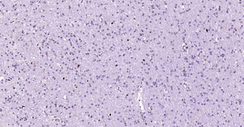 PCNA Mouse Monoclonal Antibody (Nuclear Loading Control)