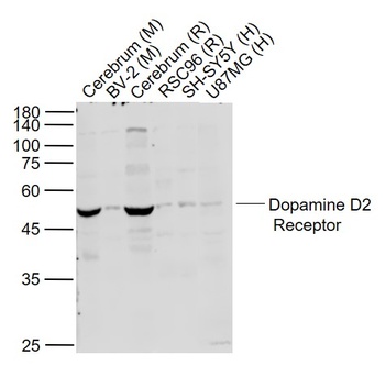 DRD2 Rabbit Polyclonal Antibody