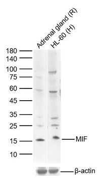 MIF Rabbit Polyclonal Antibody
