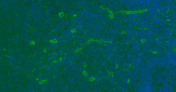 CD31 Mouse Monoclonal Antibody