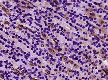 Alpha smooth muscle Actin Mouse Monoclonal Antibody