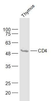 CD4 Rabbit Polyclonal Antibody