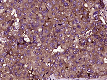 ICAM1/CD54 Mouse Monoclonal Antibody