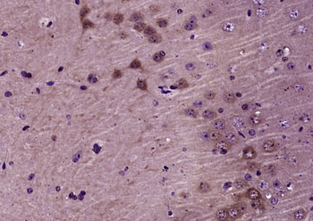ERK1/2 Mouse Monoclonal Antibody
