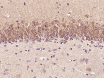 ERK1/2 Mouse Monoclonal Antibody