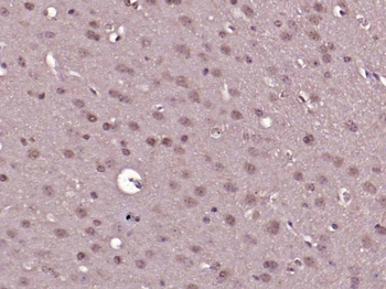 ERK1/2 Mouse Monoclonal Antibody