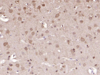 ERK1/2 Mouse Monoclonal Antibody
