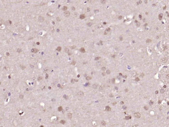 ERK1/2 Mouse Monoclonal Antibody