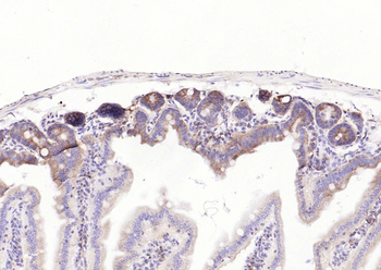 TGF beta 1 Mouse Monoclonal Antibody