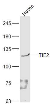 TIE2 Rabbit Polyclonal Antibody
