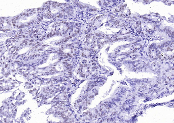 P53 Mouse Monoclonal Antibody