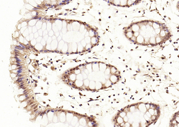 CDKN2A/p16-INK4a Rabbit Polyclonal Antibody