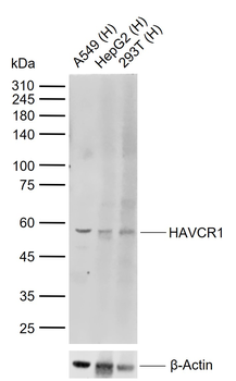 HAVCR1 Rabbit Polyclonal Antibody