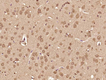 ATF6 Rabbit Polyclonal Antibody
