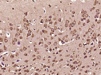 Leptin receptor Rabbit Polyclonal Antibody
