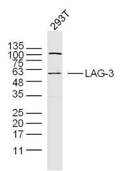 LAG3 Rabbit Polyclonal Antibody