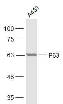 P63 Rabbit Polyclonal Antibody