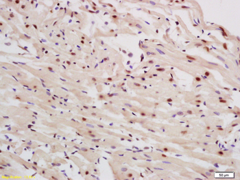 P63 Rabbit Polyclonal Antibody