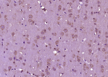 CGRP-1/2 Rabbit Polyclonal Antibody