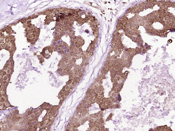 ST2 Rabbit Polyclonal Antibody