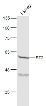 ST2 Rabbit Polyclonal Antibody