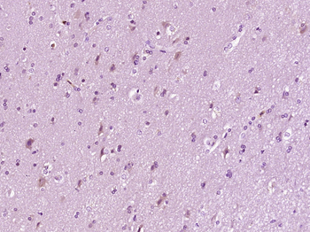 Bax Mouse Monoclonal Antibody