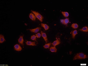 Bax Mouse Monoclonal Antibody