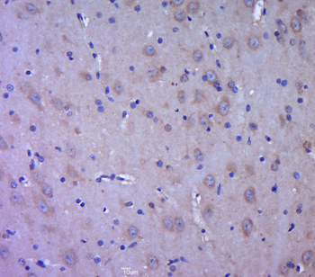 DCX/Doublecortin Rabbit Polyclonal Antibody