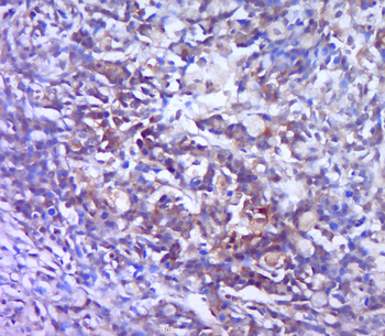 Galectin 3 Rabbit Polyclonal Antibody