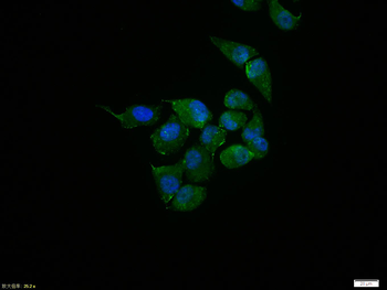 Galectin 3 Rabbit Polyclonal Antibody
