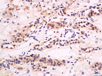 CXCL14 Rabbit Polyclonal Antibody