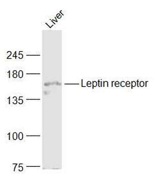 Leptin receptor Rabbit Polyclonal Antibody