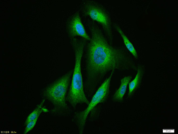 Substance P Rabbit Polyclonal Antibody